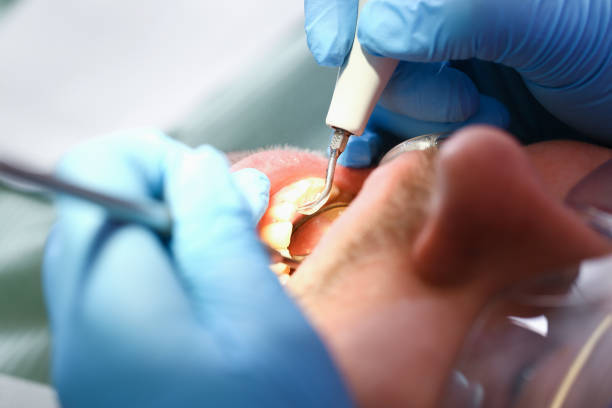 Best Dentist for Tooth Abscess  in Millville, NJ