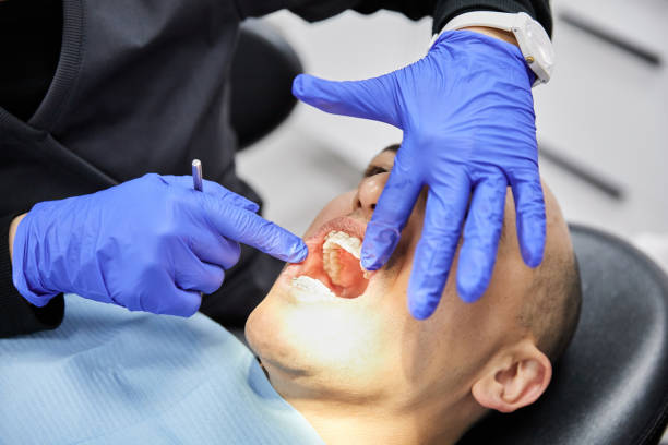 Best Chipped Tooth Repair Near Me  in Millville, NJ